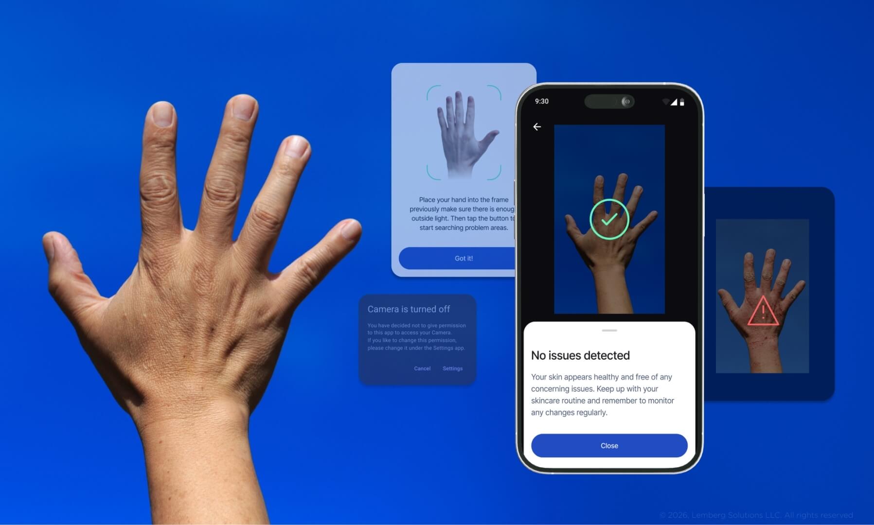 skin disease monitoring device