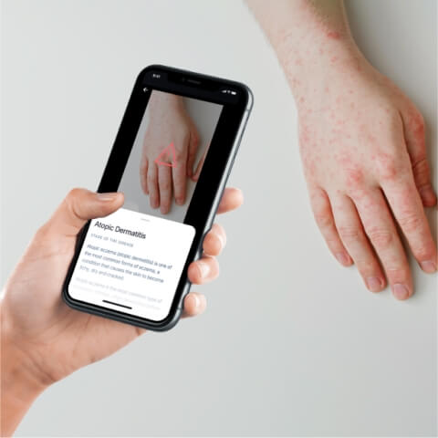 MVP of a computer vision-based app for skin disease monitoring - Overview image - Lemberg Solutions.jpg