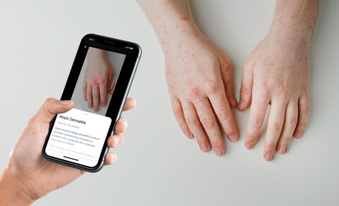 MVP of a computer vision-based app for skin disease monitoring - PDF Form - Lemberg Solutions.jpg MVP of a computer vision-based app for skin disease monitoring - PDF Form - Lemberg Solutions.jpg