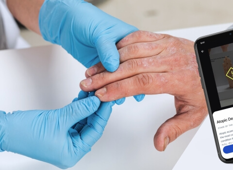  MVP of a computer vision-based app for skin disease monitoring - Section image 1 - Lemberg Solutions.jpg 