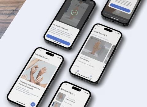  MVP of a computer vision-based app for skin disease monitoring - Section image 4 - Lemberg Solutions.jpg 